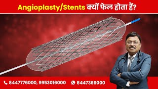 Why Angioplasty  Stents fail  Dr Bimal Chhajer  SAAOL [upl. by Lyle]