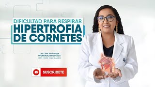 Hipertrofia de cornetes  Problemas respiratorios [upl. by Nitsua]