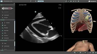 PERC Mentor Suite  An Innovative Simulator for UltrasoundGuided Pericardiocentesis [upl. by Alaik]