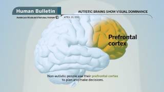 Science Bulletins Autistic Brains Show Visual Dominance [upl. by Leahey115]