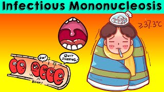 Infectious Mononucleosis IMNGlandular Fever  Causes Signs amp Symptoms Diagnosis amp Treatment [upl. by Atiuqahs]