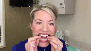 Teeth Whitening Instructions [upl. by Najram690]