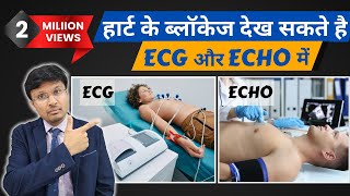 Can ECG and echocardiogram detect heart blockageMust Know facts [upl. by Doll218]