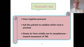 Tests for Eustachian Tube patency Valsalva manoeuvre Toynbees test [upl. by Gievlos]