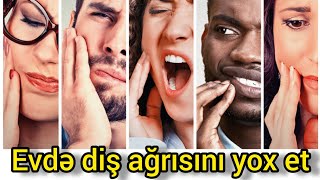 Diş ağrısını nə kəsər Dis agrisini kesmek [upl. by Domela]