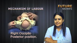 MECHANISM OF LABOURRIGHT OCCIPITO POSTERIORDHANYA DEEPUOBG [upl. by Meris]