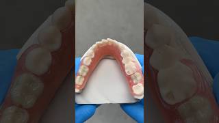 Lower TCS Unbreakable FiberFlex Partial EnvisiontecMain tcsdentalinc envisiontectcsdentalinc [upl. by Nobie]