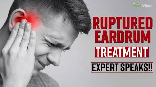 Ruptured Eardrum What Treatment According To Expert Should Be Done For Perforated Eardrum [upl. by Norreht]