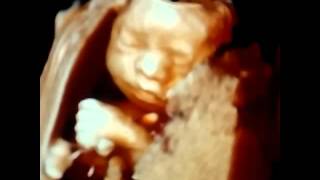 Do babies open their eyes in the womb [upl. by Finer]