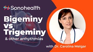 Bigeminy vs Trigeminy  PVCs amp Arrhythmias [upl. by Yelda574]