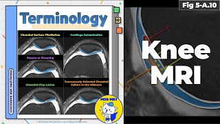 Fig 5A10 Cartilage Damage Terminology [upl. by Baird]