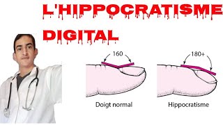 Lhippocratisme digital [upl. by Terryl]