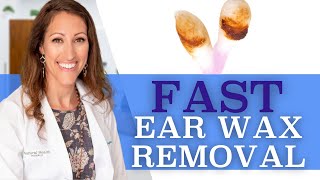 Clogged Ears  How to Remove Ear Wax At Home With Hydrogen Peroxide [upl. by Hcib]