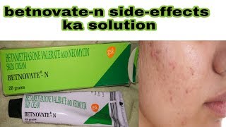 betnovate n cream ke sideeffects ka solution  how to use betnovate n cream  hindi [upl. by Pinebrook978]