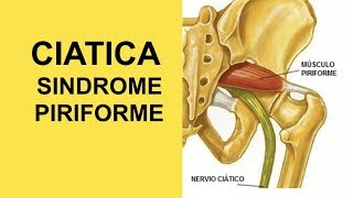 Nervio Ciatico Ejercicios Para Sindrome Piriforme y Ciatica [upl. by Emarie]