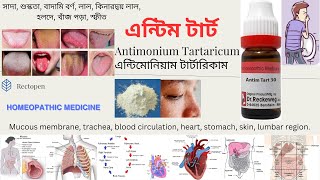 08 Antimonium Tartaricum l এন্টিম টার্ট l মেটেরিয়া মেডিকা l Materia Medical Learn Antim Tart easily [upl. by Ytoc834]