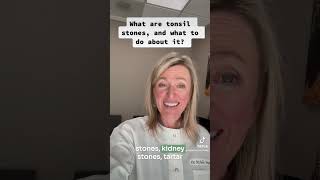 What are tonsil stones and what to do about it shorts [upl. by Crystal]