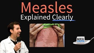 Measles rubeola Explained Clearly by MedCramcom [upl. by Kelsy83]