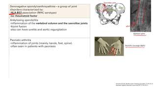 Seronegative Spondyloarthropathies  MSK  Step 1 Simplified [upl. by Llener]