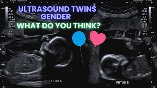 Ultrasound Pregnancy Twins Gender Identification Special interaction between the twins ❤️ [upl. by Adilen]