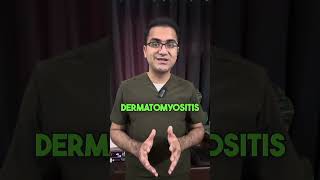 Prodoc Tip 47 Dermatomyositis and Importance of Malignancy Screening USMLE NEETPG [upl. by Elem]