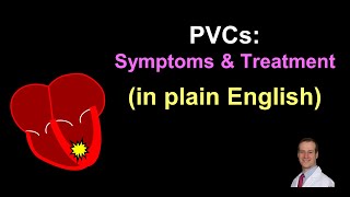 PVCs Symptoms and Treatment  in Plain English [upl. by Dionne]