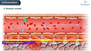 2 Acute Inflammation Vascular Events Animation [upl. by Teddie]