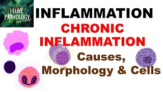 INFLAMMATION 8 CHRONIC INFLAMMATION Causes Morphology amp Cells [upl. by Oremodlab]