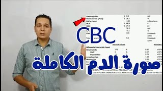 CBC ازاى تقرا تحليل صورة الدم الكاملة [upl. by Shushan924]