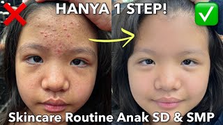 Skincare Routine Untuk Menghilangkan Jerawat Anak SD amp SMP  Christina Immanuel [upl. by Amadas]