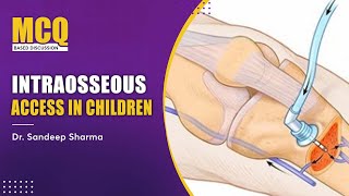 Intraosseous Access in Children General Pediatrics [upl. by Ratha451]