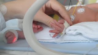 Bubble CPAP for Increased Lung Function in Premature Babies with Hany Aly MD [upl. by Tselec632]