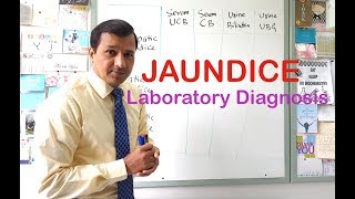 Jaundice  Laboratory Diagnosis [upl. by Abita285]