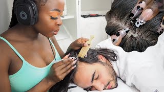 ASMR Scalp Nitpicking WHITEHEADS  Triggers FOR SLEEP  no talking 🤫 [upl. by Amilas]