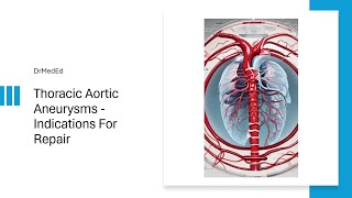 Thoracic Aortic Aneurysm  Indications For Repair [upl. by Kciredor]