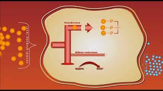 Diabetes complication Sorbitol animation [upl. by Catarina993]