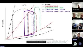 LV Distension on VA ECMO [upl. by Lanoil133]