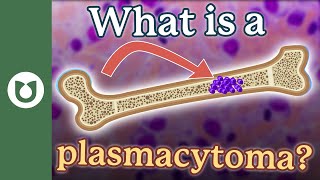 What is a plasmacytoma myeloma [upl. by Naples316]