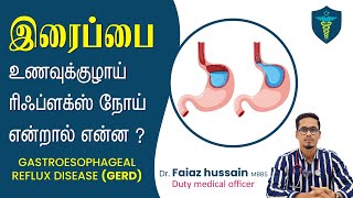 Gastroesophageal Reflux Disease எதனால் ஏற்படுகிறது Gastroesophageal Reflux Disease In TamilGERD [upl. by Oirogerg102]