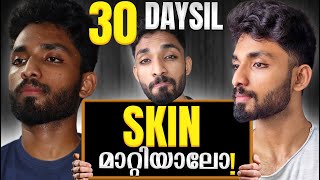 Clear ALL YOUR SKIN PROBLEMS in 30 DAYS SCIENTIFIC GUIDE to remove PIMPLES ACNE BLACKHEAD at HOME [upl. by Anitsej930]