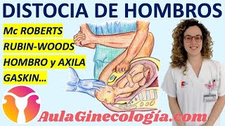 DISTOCIA DE HOMBROS MANIOBRAS DE McROBERTS RUBIN WODDS HOMBRO AXILA Ginecología y Obstetricia [upl. by Nohtan]