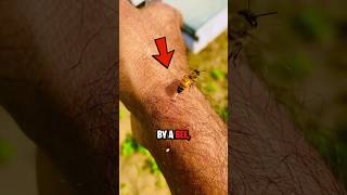 How To Survive a Bee Sting 😨 [upl. by Akenot]