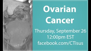 FacebookLive Ovarian Cancer [upl. by Alcus]