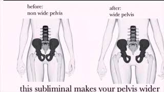 cherry wide pelvis sub extended [upl. by Inga]