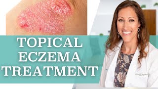 How to Treat Eczema Topically at Home [upl. by Gladys268]