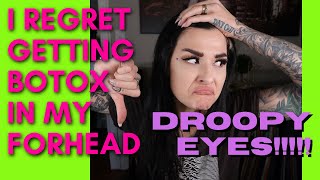 I REGET GETTING BOTOXDYSPORT in my forehead What you need to know before getting injections [upl. by Eyde]