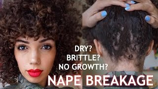 NAPE BREAKAGE  HEALTHY HAIR JOURNEY PT 4 [upl. by Lynnett775]