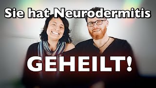 Neurodermitis geheilt 👀 Multiple Transformation der Nathalie ❤️ [upl. by Nnaecyoj]