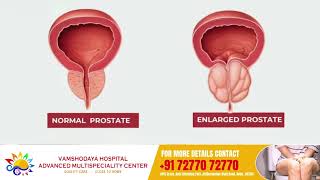 Understanding Frequent Micturition Dr Somashekar  Vamshodaya Hospitals [upl. by Scherman]