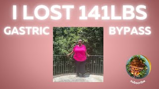 I Lost 141 Lbs Life after Retirement amp Gastric Bypass Weight Loss Update [upl. by Tigges704]